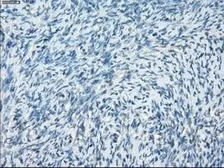 Anti-PKA I alpha reg antibody [6C7] used in IHC (Paraffin sections) (IHC-P). GTX83827