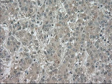 Anti-TrkC antibody [2B8] used in IHC (Paraffin sections) (IHC-P). GTX83978