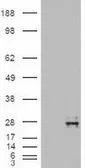 Anti-Neurotrophin 4 antibody [2E8] used in Western Blot (WB). GTX83981