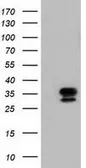 Anti-NSE2 antibody [4H9] used in Western Blot (WB). GTX83996