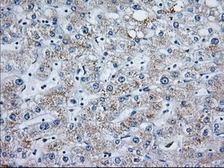 Anti-MOB1B antibody [3G9] used in IHC (Paraffin sections) (IHC-P). GTX84103