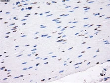 Anti-LOX antibody [5C4] used in IHC (Paraffin sections) (IHC-P). GTX84188