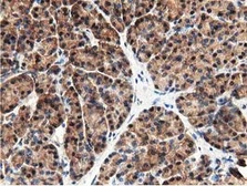 Anti-GSTT2 antibody [2E3] used in IHC (Paraffin sections) (IHC-P). GTX84400