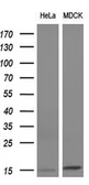 Anti-FSH beta antibody [3A9] used in Western Blot (WB). GTX84474