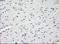 Anti-FRA1 antibody [12F9] used in IHC (Paraffin sections) (IHC-P). GTX84488