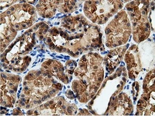 Anti-EPXH2 antibody [1H5] used in IHC (Paraffin sections) (IHC-P). GTX84569