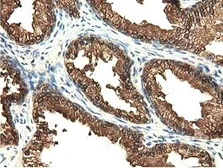 Anti-EPXH2 antibody [1A6] used in IHC (Paraffin sections) (IHC-P). GTX84570