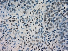 Anti-DHFR antibody [6G7] used in IHC (Paraffin sections) (IHC-P). GTX84617