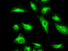 Anti-CTAG1B antibody [3F10] used in Immunocytochemistry/ Immunofluorescence (ICC/IF). GTX84651