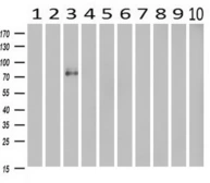Anti-CDH13 antibody [3H6] used in Western Blot (WB). GTX84697