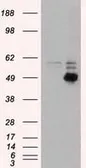 Anti-CD4 antibody [10B5] used in Western Blot (WB). GTX84720