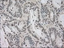 Anti-BUB1B antibody [5D9] used in IHC (Paraffin sections) (IHC-P). GTX84771
