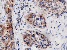 Anti-AK5 antibody [2F9] used in IHC (Paraffin sections) (IHC-P). GTX84921