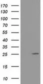 Anti-AK3 antibody [6D6] used in Western Blot (WB). GTX84931
