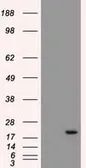 Anti-Adenylate kinase 1 antibody [4A1] used in Western Blot (WB). GTX84936