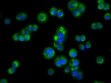 Anti-ACAT2 antibody [3C9] used in Immunocytochemistry/ Immunofluorescence (ICC/IF). GTX84971