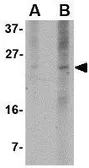 Anti-PUMA antibody [10C5G1] used in Western Blot (WB). GTX84990