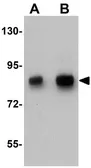 Anti-TCF12 antibody used in Western Blot (WB). GTX84997