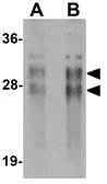 Anti-CRISP2 antibody used in Western Blot (WB). GTX85002