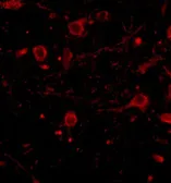 Anti-CAPS1 antibody used in IHC (Paraffin sections) (IHC-P). GTX85037