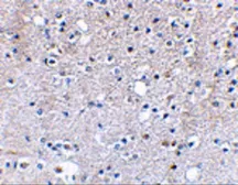 Anti-GRIK5 antibody used in IHC (Paraffin sections) (IHC-P). GTX85043