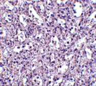 Anti-Carabin antibody used in IHC (Paraffin sections) (IHC-P). GTX85050