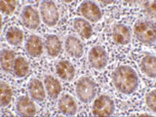Anti-AATF antibody used in IHC (Paraffin sections) (IHC-P). GTX85086