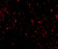 Anti-MD2 antibody [9F1B1] used in IHC (Paraffin sections) (IHC-P). GTX85122