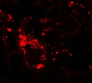 Anti-SLC39A6 antibody used in IHC (Paraffin sections) (IHC-P). GTX85131