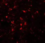 Anti-ZIP5 antibody used in IHC (Paraffin sections) (IHC-P). GTX85132
