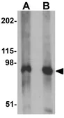 Anti-Synaptopodin antibody used in Western Blot (WB). GTX85140