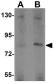 Anti-APBA2 antibody used in Western Blot (WB). GTX85144