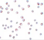 Anti-ATG9B antibody used in Immunocytochemistry/ Immunofluorescence (ICC/IF). GTX85184