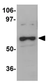 Anti-WDR40A antibody used in Western Blot (WB). GTX85189