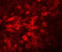 Anti-TMEM70 antibody used in IHC (Paraffin sections) (IHC-P). GTX85199
