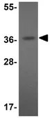 Anti-ELOVL7 antibody used in Western Blot (WB). GTX85201