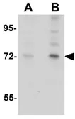Anti-ARHGAP18 antibody used in Western Blot (WB). GTX85208