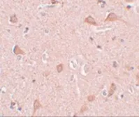 Anti-SIPA1L1 antibody used in IHC (Paraffin sections) (IHC-P). GTX85228