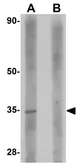 Anti-SKA2 antibody used in Western Blot (WB). GTX85247