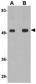 Anti-TMEM214 antibody used in Western Blot (WB). GTX85256