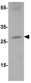 Anti-ZBED3 antibody used in Western Blot (WB). GTX85290
