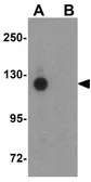 Anti-PCDH18 antibody used in Western Blot (WB). GTX85299