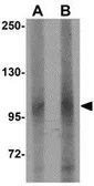 Anti-LRFN1 antibody used in Western Blot (WB). GTX85345