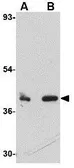 Anti-CUEDC1 antibody used in Western Blot (WB). GTX85378