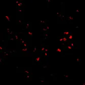 Anti-PARL antibody used in Immunocytochemistry/ Immunofluorescence (ICC/IF). GTX85382