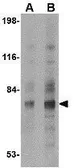 Anti-Syntaphilin antibody used in Western Blot (WB). GTX85397