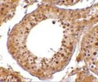 Anti-RGPD5 antibody used in IHC (Paraffin sections) (IHC-P). GTX85402