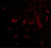 Anti-CAPS2 antibody used in IHC (Paraffin sections) (IHC-P). GTX85405