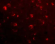 Anti-SLITRK6 antibody used in IHC (Paraffin sections) (IHC-P). GTX85411