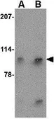 Anti-Slitrk4 antibody used in Western Blot (WB). GTX85415